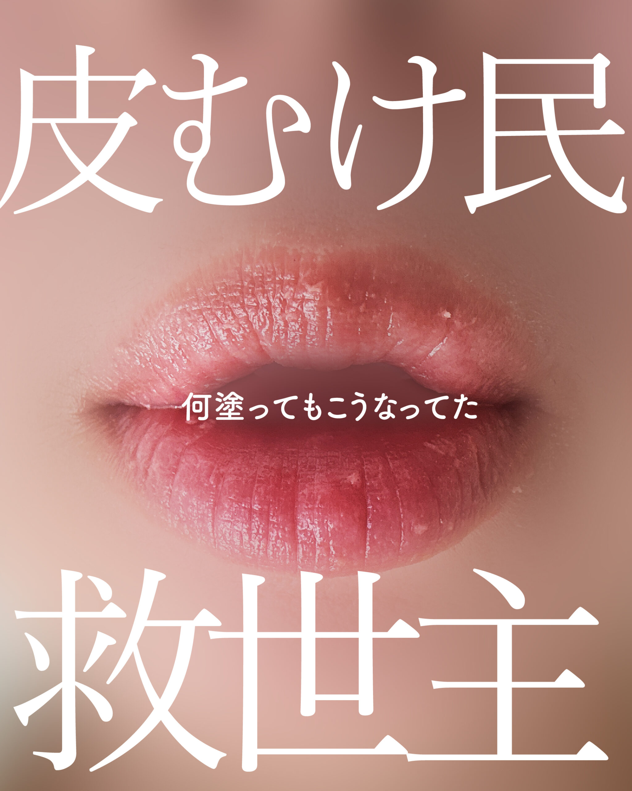 唇の皮がむける女性の顔のアップ