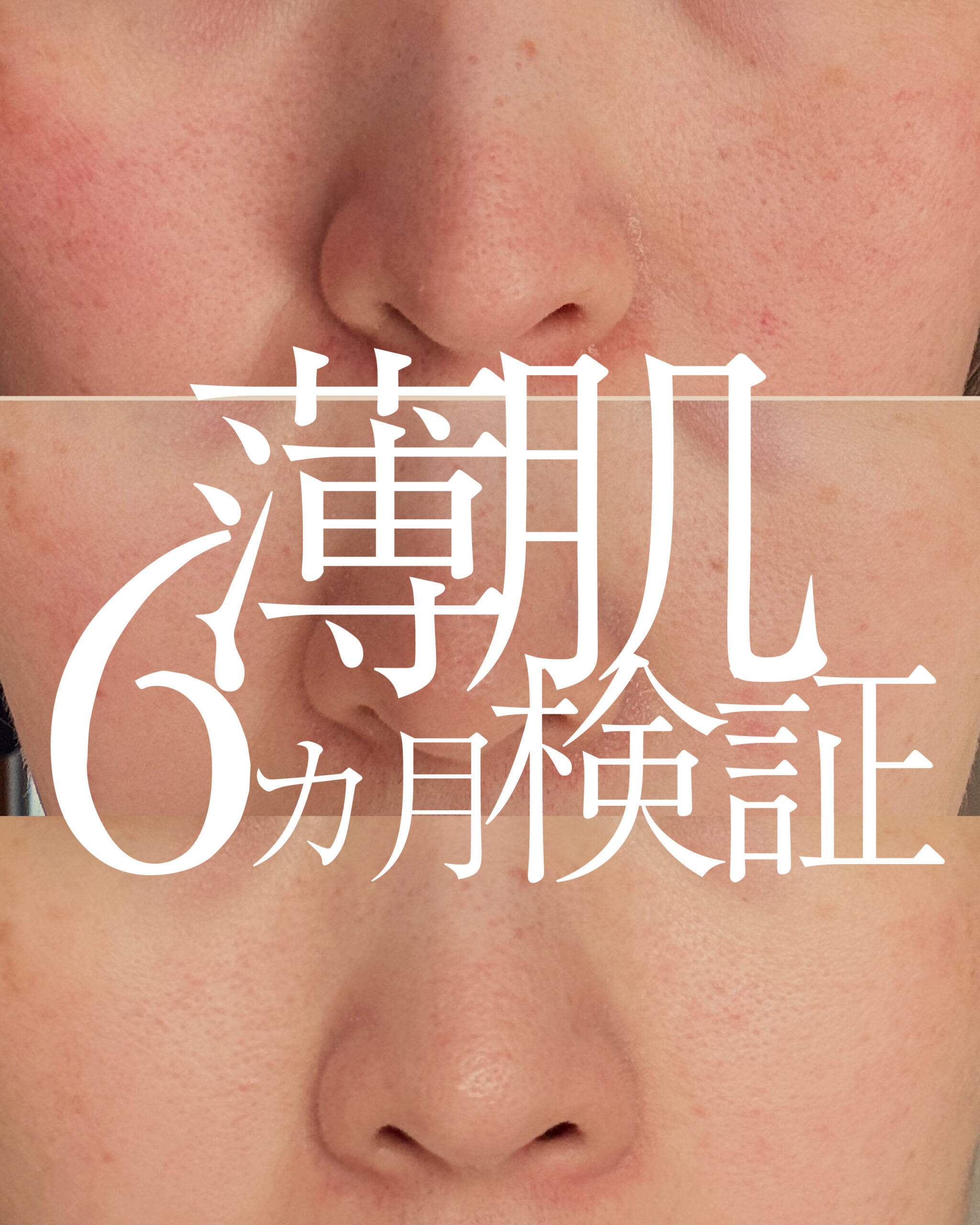 薄肌6か月検証